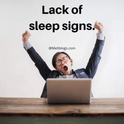 Lack of sleep signs.
