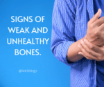 Signs of weak and unhealthy bones.