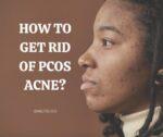 How to get rid of PCOS acne