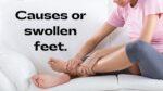 Causes of swollen feet