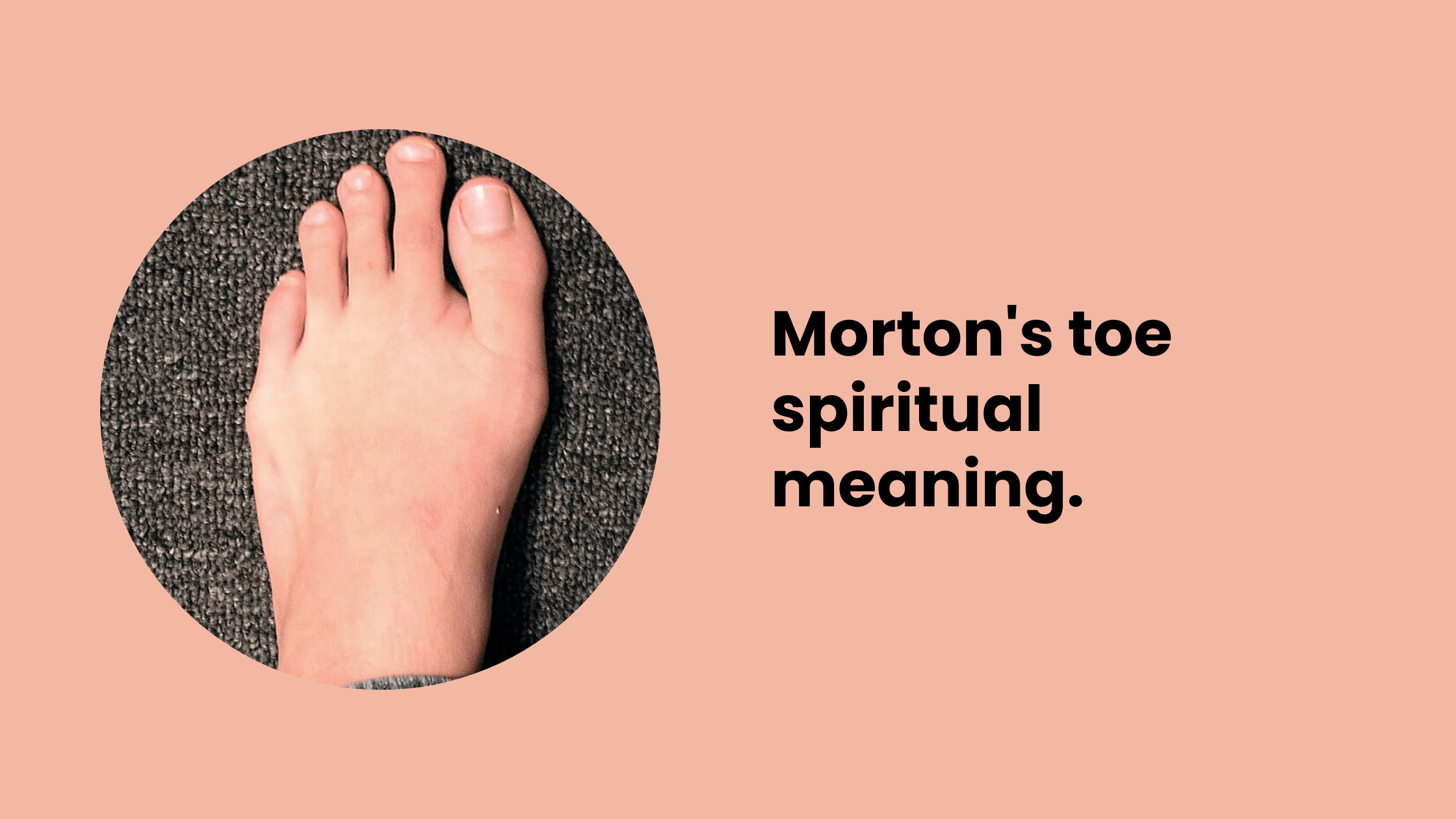 Morton's toe spiritual meaning. - MELTBLOGS